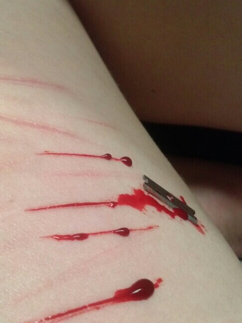 young girl, depressed, cutting, dying...