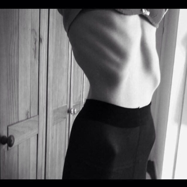 my scars tell a story