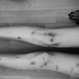19. Depressed. Apettite disorders. Hyperthyroidism. If you want to talk, I'm here to listen ♥.