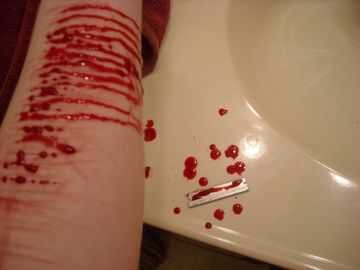 14|Suicidal|Depressed|Self harming|My paint brush is a razor and the canvas is my wrist|I don't want to give up, but I'm guessing my body does|