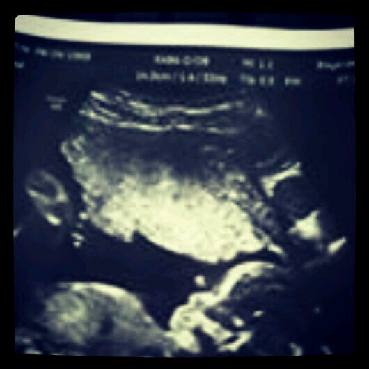 O6.O5.11 & 12.15.13 Danyell& Donyell.