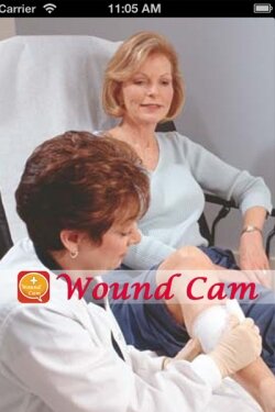 A sophisticated app that can keep a track record of wound healing.