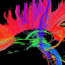 AI/ML engineer & PhD Telecom Engineer / Interested in Big Data, Computer vision and artificial intelligence in medicine. Opinions are my own.