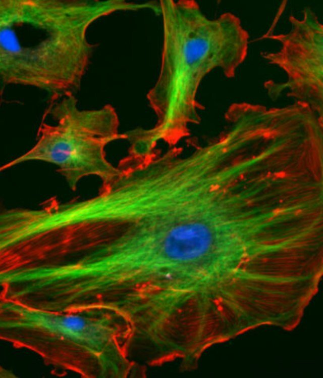 cytoskeleton123's profile picture. I'm the organelle that holds this cells shape together, and I even enable cellular motion, protect the cell, and help with cell division and transportation.