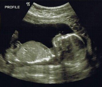 My Daddy is @DarkenedCharm My Momma is: @DegenerateMinx