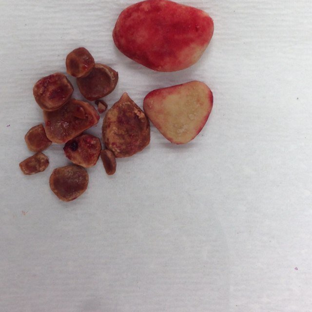 tweet_endo's profile picture. Twitter Working group for Endurology Evaluation and Training