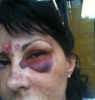VICTIMofDUTCHPOLICE&RACISM my life is Destroyed by DUTCH RACISM judges&lawyers/phedofile DICTATORSHIP LAND of FACADE