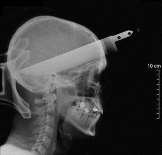 ~ill stop stabbing when you stop screaming~ ~they cant hear you~ chiodos