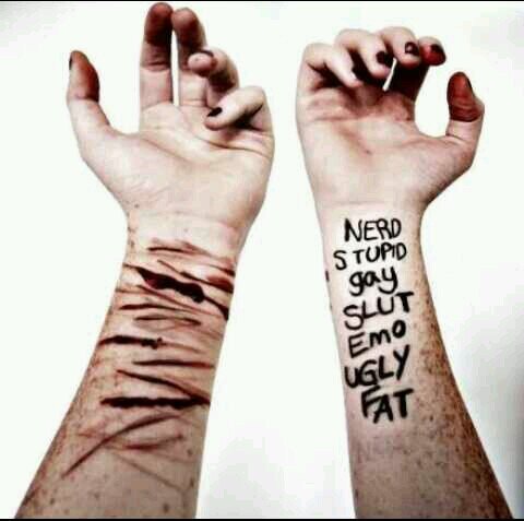 14 ~ depressed ~ fat ~ hoping for an end ~ music gives hope ~ directioner