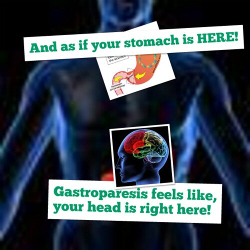 We support those with GP and anxiety and maintain that anxiety is a SYMPTOM of gastroparesis! http://t.co/UbaCNkqWwG