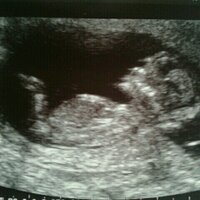 laura brown (@laurab3262) 's Twitter Profile