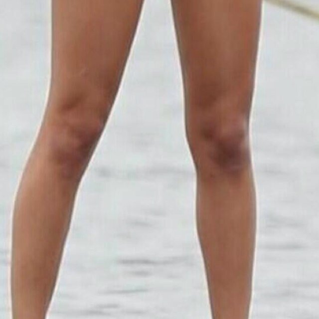 Hi I am the knees of taylor swift and even thought knees are ugly these knees are attractive bc they belong to taylor swift