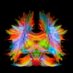 Maxime Descoteaux (@maxdescoteaux) Twitter profile photo Maxime Descoteaux (@maxdescoteaux) Twitter profile photo