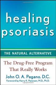 Tips for naturally healing your psoriasis through lifestyle changes.