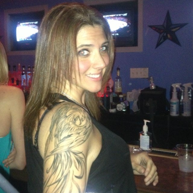 -Spreading my journey of skin removal surgery -