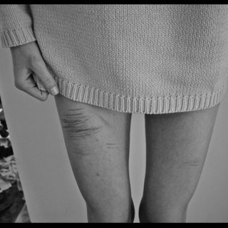 Sassyb1tch3s's profile picture. self harmer for 3 years, anexity and bullimia sufferer. 16 years old:)