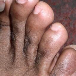 A foot lover - and a big fan of the pinky toe!
