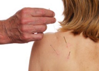 Acupuncture treatment with Clare Trohear and Tim Spauls with clinics in Formby & Southport.