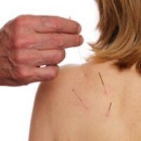 Sefton Acupuncture (@seftonclinic) Twitter profile photo