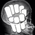 Radiopaedia.org (@radiopaedia) Twitter profile photo Radiopaedia.org (@radiopaedia) Twitter profile photo