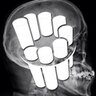 Radiopaedia's profile picture. Free online collaborative radiology resource. Articles, cases, courses, podcast #foamed #foamrad