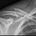 Profile Picture of Rodgers Collar Bone (@AaronCollarBone) on Twitter