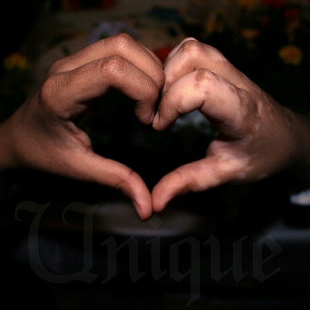 ‏‏‏Instagram: ‎‎‎@colorfulsaudis  مشروع توعوي عن البهاق والبرص