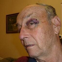Leafs Fan defending Leaf nation! Cost me a black eye!