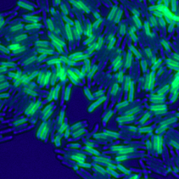 Our lab develops quantitative methods to design therapies for tuberculosis and to understand complex cell behaviors.