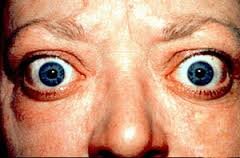 Condition in which the thyroid gland produces too much thyroid hormone, which causes things in the body to speed up