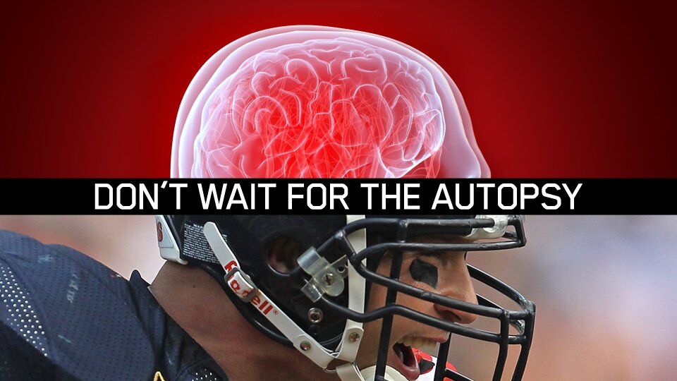 TBI, concussion, CTE, Neuropathology