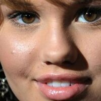 Pimple Marks Removal (@gameallpc) Twitter profile photo
