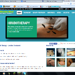 We are certified HIRUDOTHERAPIST known as passionate practitioners for healing and beauty treatments. We provide LEECHES THERAPY, known as HIRUDOTHERAPY