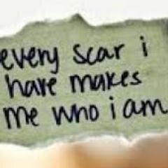 I'm 14. Relapsed. Bulimic and Anorexic cycles. Depressed. Have anxiety and OCD. Self harm.