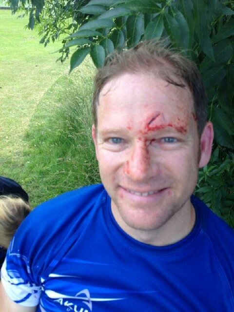 Big Frase - used to play rugby a bit and now is just a bon viveur