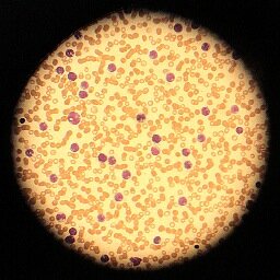 Science Through Art. An international  network of scientists, artists and musicians exploring the overlap of science, medicine, music and the arts.