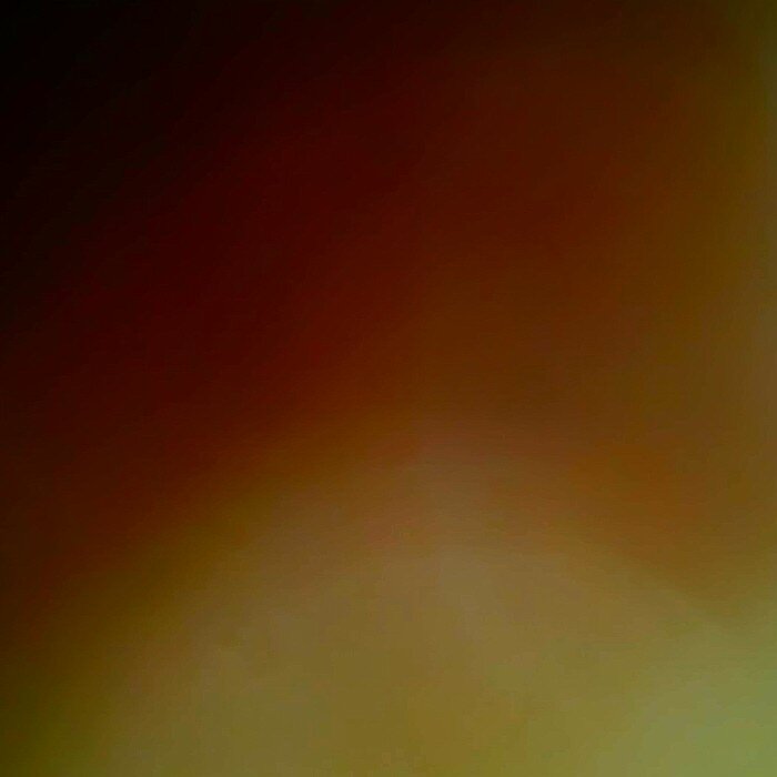 اتصل نصل (خاص)