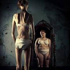 Anorexia y ganas de morir