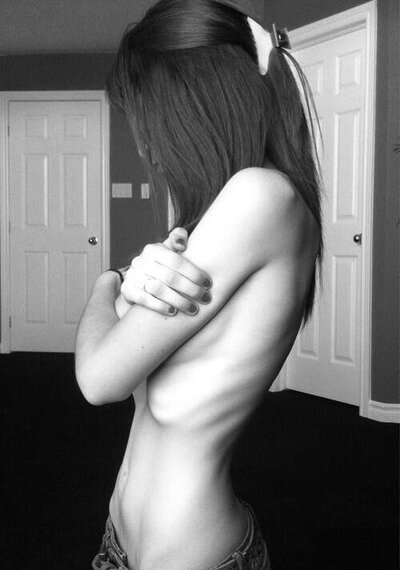 16. Self harm. fatty. SW: 140 CW: 126 GW: 100.