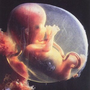 achanceatlife's profile picture. We speak for those who cannot,help us in our fight to end abortion.Please sign our petition. https://t.co/6KMJE0kwu1