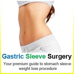 Find high user-value information on gastric sleeve weight loss surgery. ❤️ We facilitate quality and low cost gastric sleeve in Mexico, Costa Rica, and India.