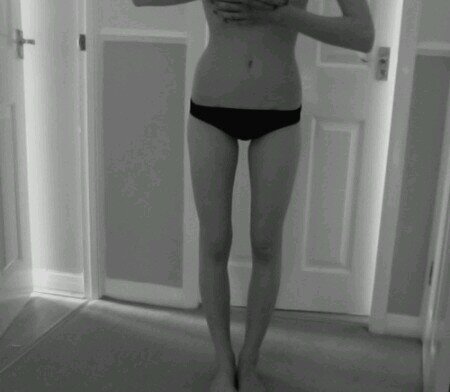 im a 13 year old girl. I Cut. Im suicidal. Im depressed. And, I am ANOREXIC