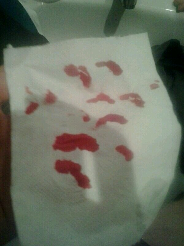 15. Muerta en vida. Intentando que la autolesion forme parte de mi pasado. Arañazos. Hate.