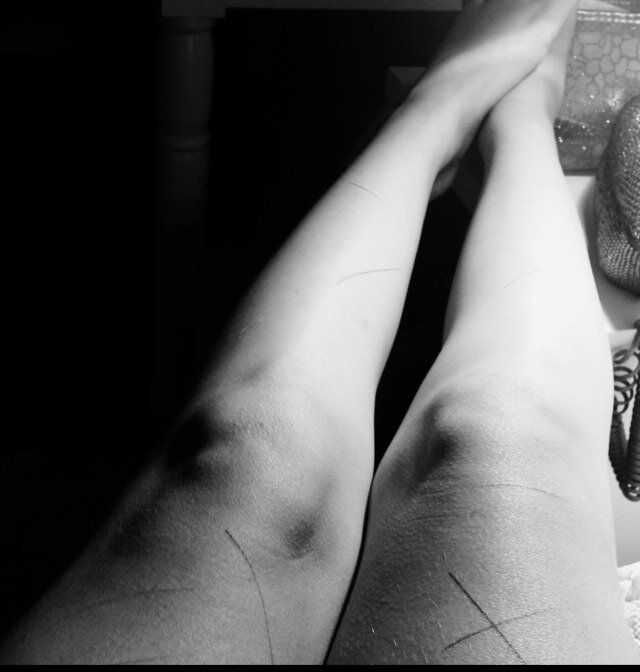 lifestupidlife's profile picture. odio al espejo. cicatrices desde los 10. simplemente necesito juntar el valor para matarme y punto.mi meta: 20kg