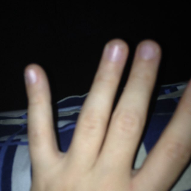 Help my brother to go out of the hospital :,(