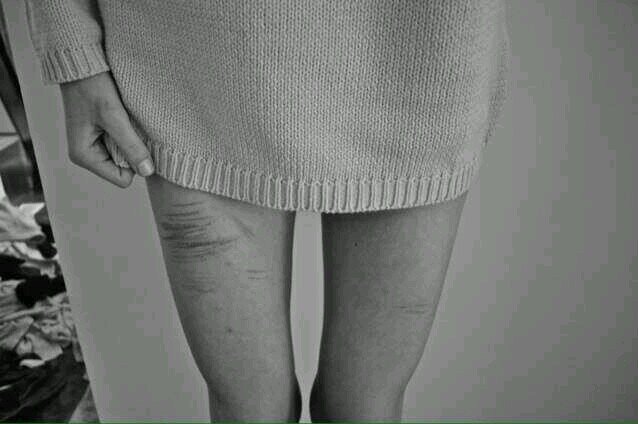 ●Depression, Anxiety, Self-Harm, Suicidal●
