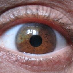 Retired accountant, golfer, olive lover, Raider fan, Auburn fan, Sectoral Heterochromatic