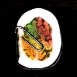 MindTrojan's profile picture. Thoughts and Qs are overflowing in my mental shell. This trojan is supporting and reveals here..