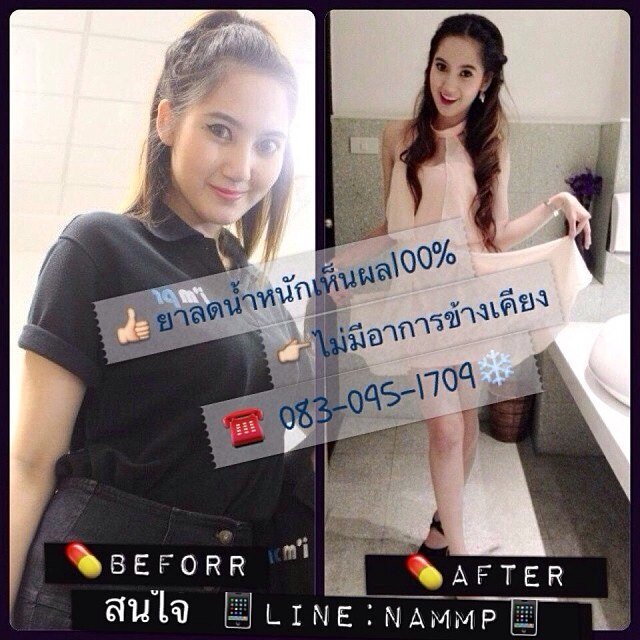 ยาลดความอ้วน จากมือหมอ ราคากับคุณภาพคุ้มกับชีวิตของท่าน เปลี่ยนร้านแต่ไลน์+เบอร์โทรเดิมคะ IG : Slim_de_TSP Line: NAMMP Tel.083-0951-709