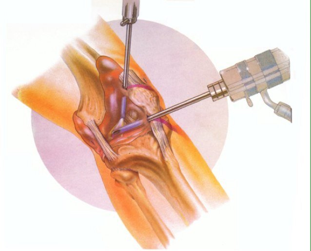 jmsamaradiaga's profile picture. Traumatologo y Ortopeda Subespecialista en Cirugia de Rodilla y Cirugia Artroscopica